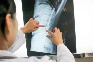 Chicago spine surgery error lawyer