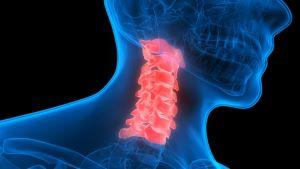Cook County cervical spine injury lawyer