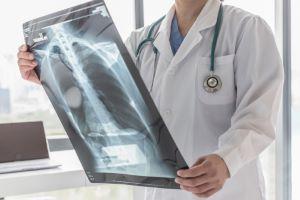 Chicago medical negligence attorney for misdiagnosis